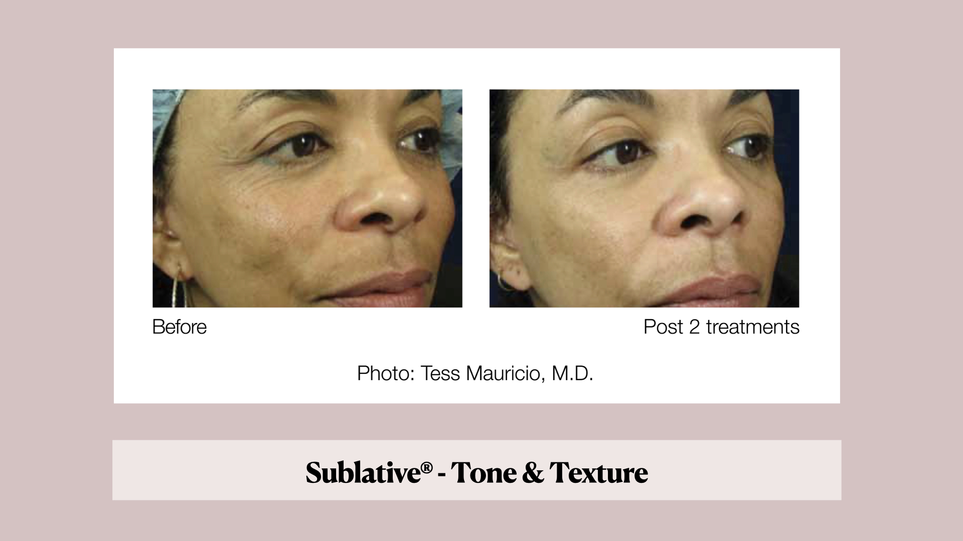 EveryskinMD – skincare solutions for all skin types